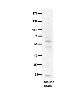 PDE9A Rabbit Polyclonal Antibody