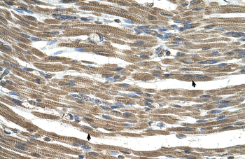 GATD3A Rabbit Polyclonal Antibody