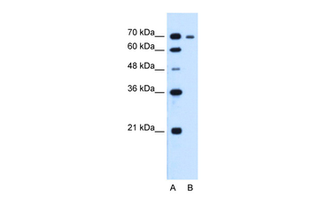 RRM1 Rabbit Polyclonal Antibody