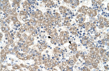KYNU Rabbit Polyclonal Antibody