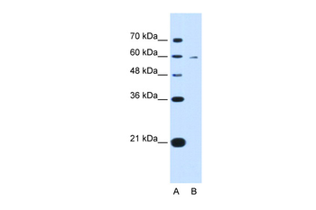KYNU Rabbit Polyclonal Antibody