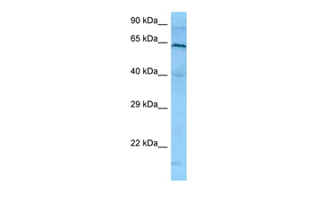PLK1 Rabbit Polyclonal Antibody