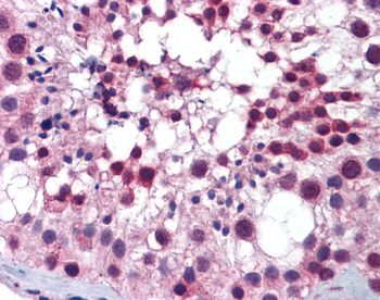 PLK1 Rabbit Polyclonal Antibody