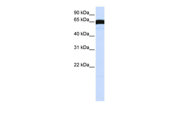 PLK1 Rabbit Polyclonal Antibody
