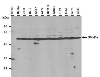 IFI44 Rabbit Polyclonal Antibody