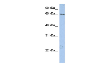 PUM3 Rabbit Polyclonal Antibody