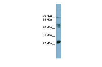 MPZL1 Rabbit Polyclonal Antibody