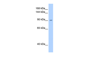 OSMR Rabbit Polyclonal Antibody