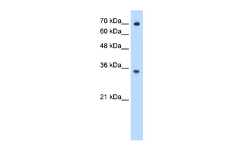 FCGRT Rabbit Polyclonal Antibody
