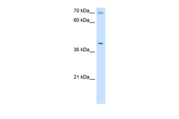 COX15 Rabbit Polyclonal Antibody