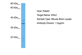 EFNB1 Rabbit Polyclonal Antibody
