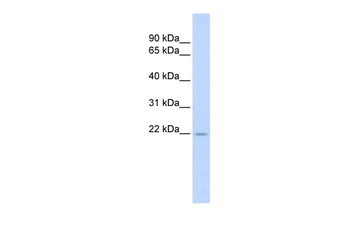 TNFSF18 Rabbit Polyclonal Antibody