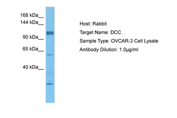 DCC Rabbit Polyclonal Antibody