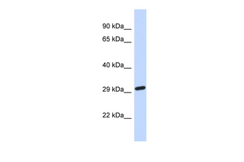 NAALAD2 Rabbit Polyclonal Antibody