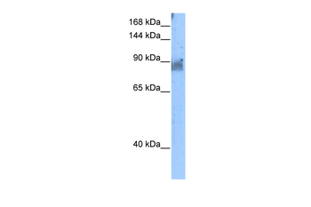 NELL2 Rabbit Polyclonal Antibody