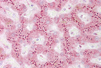TGOLN2 Rabbit Polyclonal Antibody