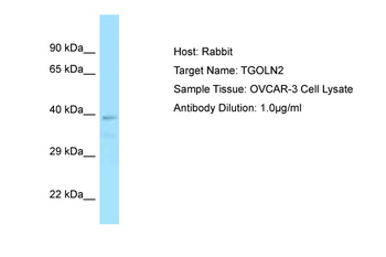 TGOLN2 Rabbit Polyclonal Antibody