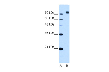 CORIN Rabbit Polyclonal Antibody