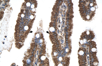 PGRMC1 Rabbit Polyclonal Antibody