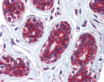 CKAP4 Rabbit Polyclonal Antibody