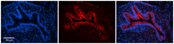 CKAP4 Rabbit Polyclonal Antibody