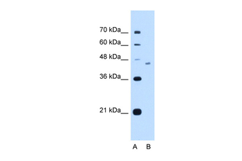 FICD Rabbit Polyclonal Antibody