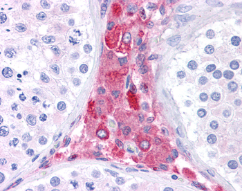 BACE1 Rabbit Polyclonal Antibody