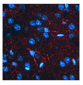 BACE1 Rabbit Polyclonal Antibody