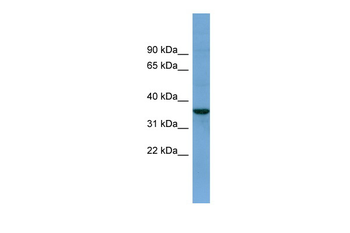 BACE2 Rabbit Polyclonal Antibody