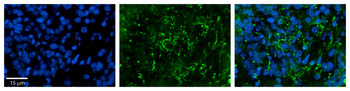 ZDHHC17 Rabbit Polyclonal Antibody