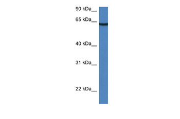 Lgi2 Rabbit Polyclonal Antibody