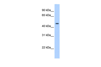 SERPINE1 Rabbit Polyclonal Antibody