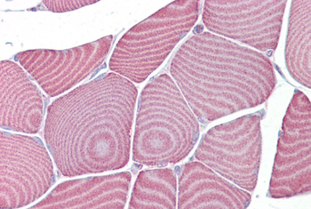 FABP3 Rabbit Polyclonal Antibody