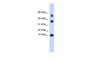 FABP3 Rabbit Polyclonal Antibody