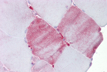 FABP3 Rabbit Polyclonal Antibody
