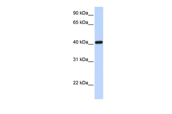 IRX6 Rabbit Polyclonal Antibody