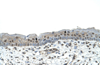 NR2C2 Rabbit Polyclonal Antibody