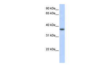 TMEM173 Rabbit Polyclonal Antibody