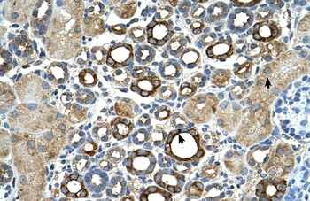 ST14 Rabbit Polyclonal Antibody