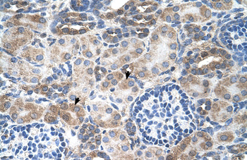 SLC14A1 Rabbit Polyclonal Antibody