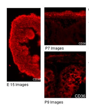 CD36 Rabbit Polyclonal Antibody