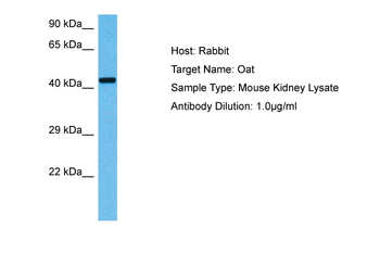 OAT Rabbit Polyclonal Antibody