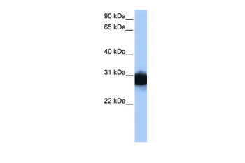 TPI1 Rabbit Polyclonal Antibody