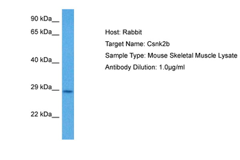 Csnk2b Rabbit Polyclonal Antibody