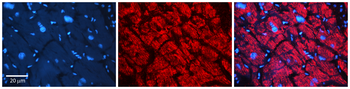 AKR1B1 Rabbit Polyclonal Antibody