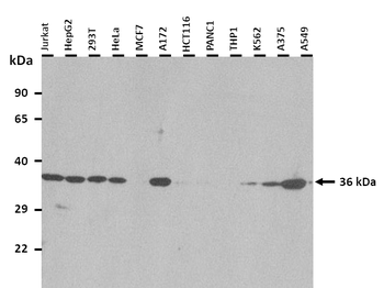 AKR1B1 Rabbit Polyclonal Antibody