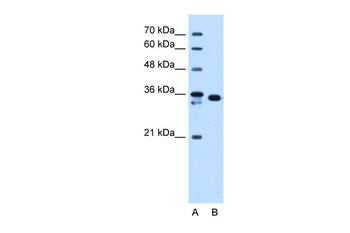 AKR1B1 Rabbit Polyclonal Antibody