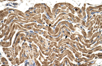 ATP5F1B Rabbit Polyclonal Antibody