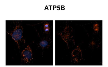 ATP5F1B Rabbit Polyclonal Antibody