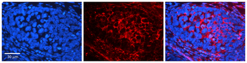 VIM Rabbit Polyclonal Antibody